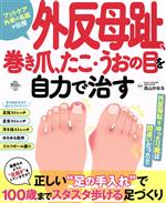 【中古】 外反母趾 巻き爪 たこ・うおの目を自力で治す FUSOSHA MOOK／高山かおる 監修 