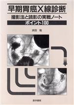 【中古】 早期胃癌X線診断　撮影法と読影の実戦ノート　ポイント100／浜田勉(著者)