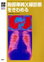 【中古】 胸部単純X線診断をきわめる／酒井文和(著者)