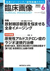 臨床画像 2022年6月号 特集:特集:放射線診断医を悩ませる全身イメージング/特別掲載:原発性アルドステロン症のラジオ波焼灼治療