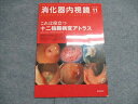 東京医学社 消化器内視鏡 2012年11月号 Vol.24 No.11 006m3D