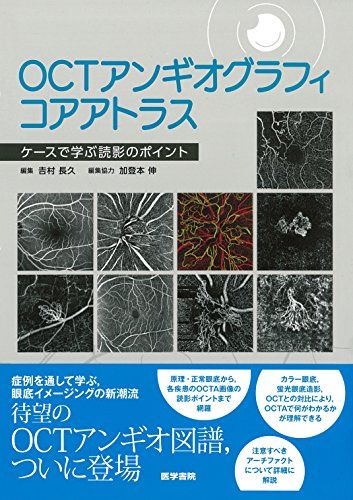 楽天市場】octアンギオグラフィコアアトラス:（科学・医学・技術