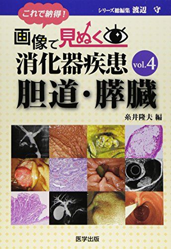 これで納得!画像で見ぬく消化器疾患 (vol.4)