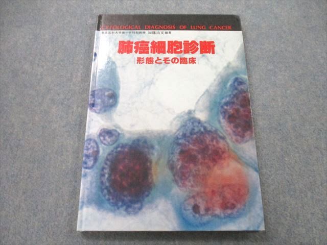 UB26-034 ベクトル・コア 肺癌細胞診断 形態とその臨床 1989 加藤治文 13S3A