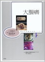 腫瘍病理鑑別診断アトラス 大腸癌 八尾 隆史