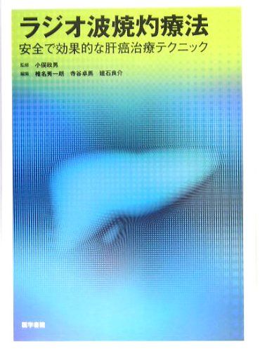 ラジオ波焼灼療法: 安全で効果的な肝癌治療テクニック 小俣 政男