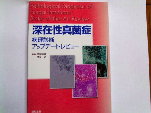 深在性真菌症―病理診断アップデートレビュー [単行本] 久米光; 渋谷和俊