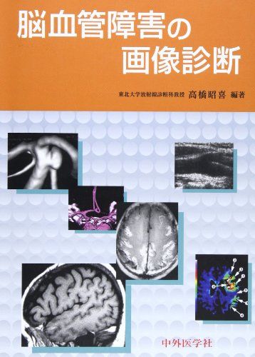 脳血管障害の画像診断 高橋 昭喜