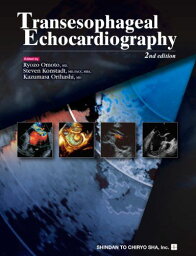 Transesophageal Echocardiography