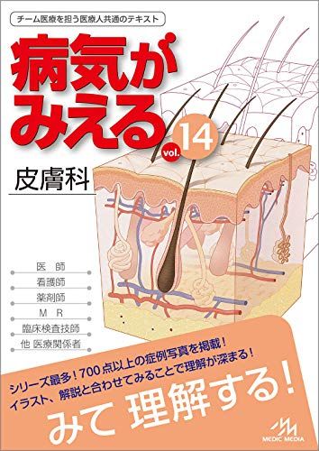 病気がみえる vol.14 皮膚科 単行本（ソフトカバー） 医療情報科学研究所