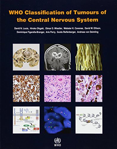 WHO Classification of Tumours of the Central Nervous System (WHO Health Organization Classification of Tumours) [y[p[obN] I