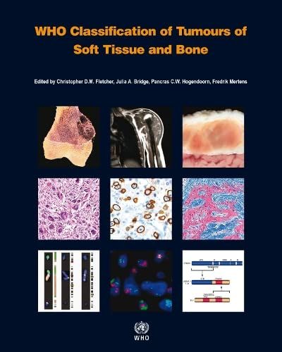 WHO Classification of Tumours of Soft Tissue and Bone (World Health Organization Classification of Tumours) FletcherCChrist