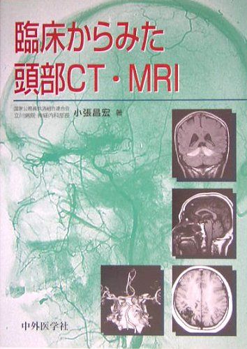臨床からみた頭部CT・MRI [単行本] 小張 昌宏