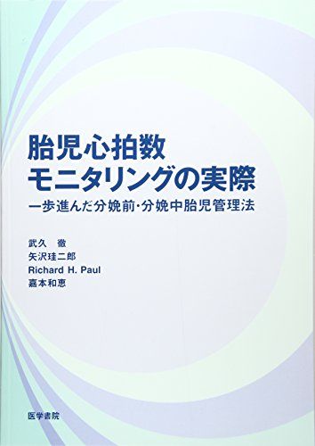 胎児心拍数モニタリングの実際—一