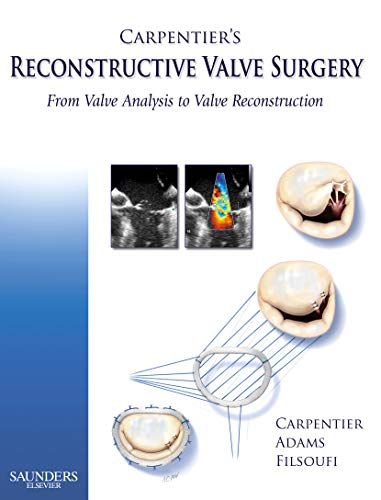 Carpentier's Reconstructive Valve Surgery 1e