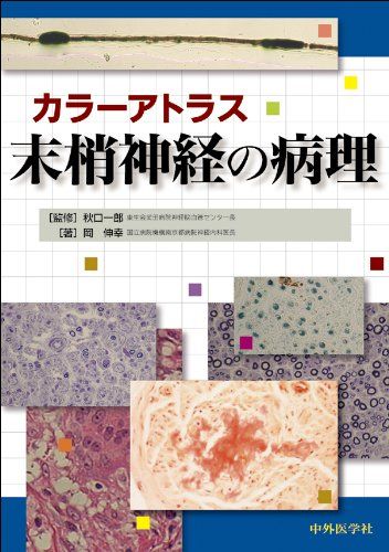 カラーアトラス末梢神経の病理 [大型本] 岡 伸幸; 秋口 一郎