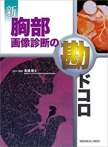 新 胸部画像診断の勘ドコロ  高橋 雅士