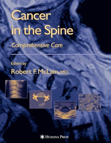 Cancer in the Spine: Comprehensive Care (Current Clinical Oncology) [ペーパーバック] various， .、 McLain， Robert F.、 Markma..