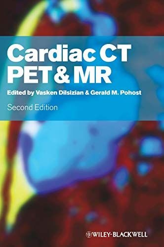 Cardiac CTC PET and MR DilsizianC Vasken; PohostC Gerald M.