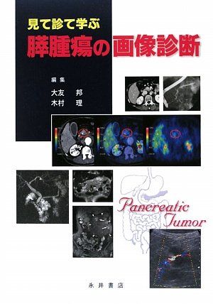 見て診て学ぶ膵腫瘍の画像診断 [単行本] 邦，大友; 理，木村