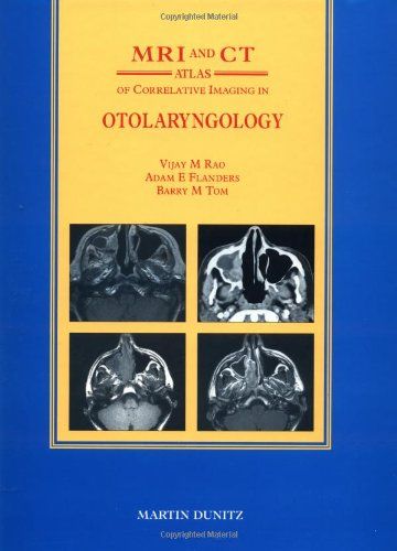 MRI and CT Atlas of Correlative Imaging in Otolaryngology Flanders Adam E Rao Vijay M; Tom Barry M