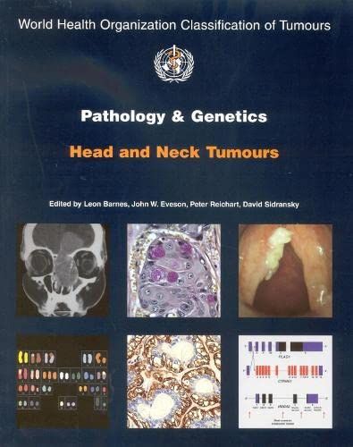 Pathology And Genetics of Head and Neck Tumours (World Health Organization Classification of Tumours) BarnesC LeonA EvesonC