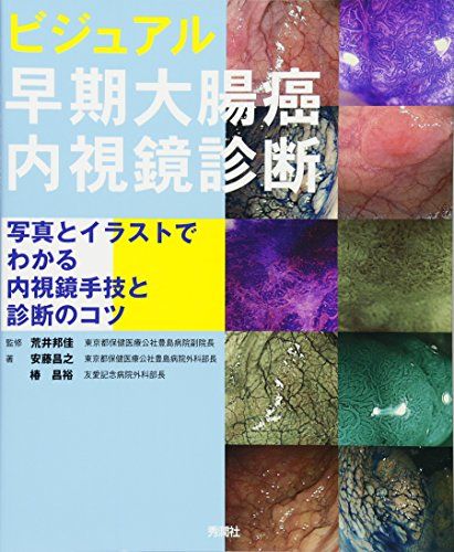 Science, Medicine, Technology - ビジュアル 早期大腸癌内視鏡診断: 写真とイラストでわかる内視鏡手技と診断のコツ 荒井邦佳