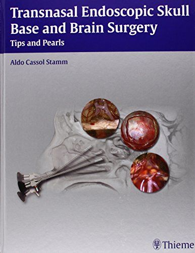 Transnasal Endoscopic Skull Base and Brain Surgery: Tips and Pearls [ハードカバー] Stamm， Aldo Cassol; Rhoton， Albert L.， Jr.， Ph.D.