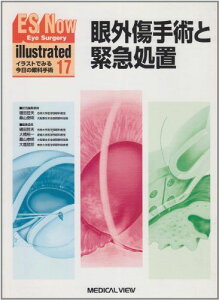 ES now illustrated no.17-イラストでみる今日の眼科手術 眼外傷手術と緊急処置 樋田 哲夫