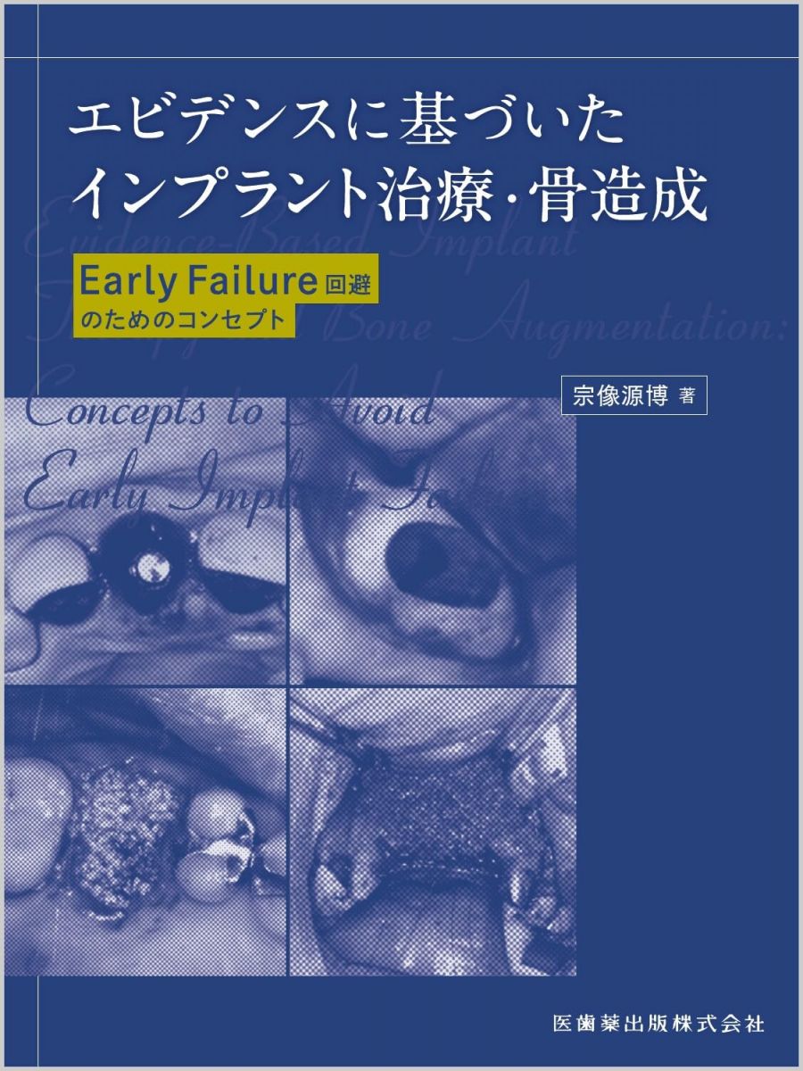 エビデンスに基づいたインプラント治療・骨造成: Early Failure回避のためのコンセプト