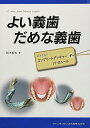 よい義歯 だめな義歯