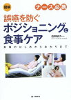 図解 ナース必携 誤嚥を防ぐポジショニングと食事ケア―食事のはじめからおわりまで [単行本] 綾子， 迫田