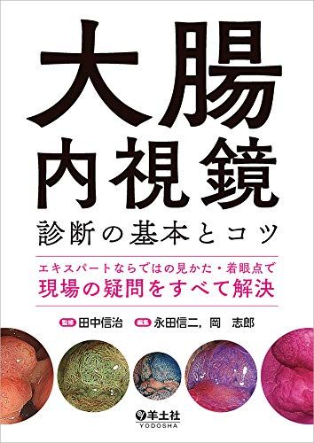 大腸内視鏡診断の基本とコツ-エキスパートならではの見かた・着眼点で現場の疑問をすべて解決
