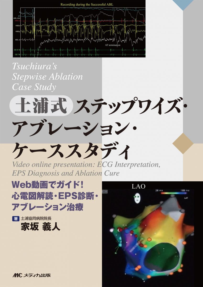 Tsuchiura&#039;s Stepwise Ablation Case Study 土浦式ステップワイズ・アブレーション・ケーススタディ: Video online presentation: ECG Interpretation EPS Diagnosi