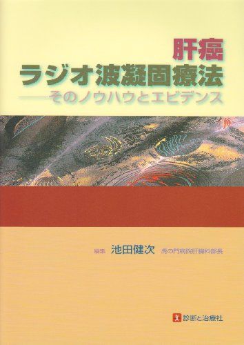 肝癌ラジオ波凝固療法