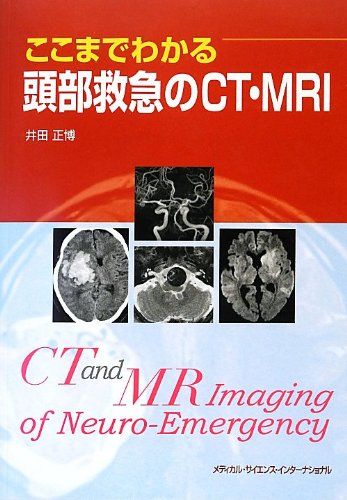ここまでわかる頭部救急のCT・MRI 井田正博