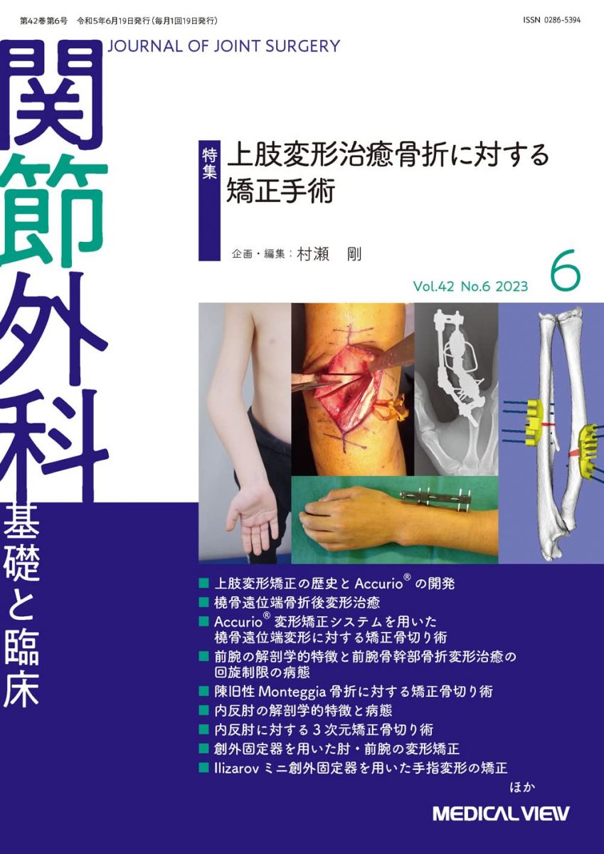 【30日間返品保証】商品説明に誤りがある場合は、無条件で弊社送料負担で商品到着後30日間返品を承ります。【最短翌日到着】正午12時まで（日曜日は午前9時まで）の注文は当日発送（土日祝も発送）。関東・関西・中部・中国・四国・九州地方は翌日お届け、東北地方・新潟県・北海道・沖縄県は翌々日にお届けします。【インボイス制度対応済み】当社ではインボイス制度に対応した適格請求書発行事業者番号（通称：T番号・登録番号）を印字した納品書（明細書）を商品に同梱してお送りしております。こちらをご利用いただくことで、税務申告時や確定申告時に消費税額控除を受けることが可能になります。また、適格請求書発行事業者番号の入った領収書・請求書をご注文履歴からダウンロードしていただくこともできます（宛名はご希望のものを入力していただけます）。ご満足のいく取引となるよう精一杯対応させていただきます。※下記に商品説明およびコンディション詳細、出荷予定・配送方法・お届けまでの期間について記載しています。ご確認の上ご購入ください。■商品名■関節外科 -基礎と臨床 2023年6月号 特集：上肢変形治癒骨折に対する矯正手術■出版社■メジカルビュー社■著者■村瀬 剛■発行年■2023/05/19■ISBN10■B0C3KBB84D■ISBN13■■コンディションランク■非常に良いコンディションランク説明ほぼ新品：未使用に近い状態の商品非常に良い：傷や汚れが少なくきれいな状態の商品良い：多少の傷や汚れがあるが、概ね良好な状態の商品(中古品として並の状態の商品)可：傷や汚れが目立つものの、使用には問題ない状態の商品■コンディション詳細■書き込みありません。古本ではございますが、使用感少なくきれいな状態の書籍です。弊社基準で良よりコンデションが良いと判断された商品となります。水濡れ防止梱包の上、迅速丁寧に発送させていただきます。【発送予定日について】正午12時まで（日曜日は午前9時まで）のご注文は当日に発送いたします。正午12時（日曜日は午前9時）以降のご注文は翌日に発送いたします（土曜日・日曜日・祝日も発送しています）。※土曜日・祝日も正午12時までのご注文は当日に発送いたします。※年末年始（12/31〜1/3）は除きます。(例)・月曜0時〜12時までのご注文：月曜日に発送・月曜12時〜24時までのご注文：火曜日に発送・土曜0時〜12時までのご注文：土曜日に発送・土曜12時〜24時のご注文：日曜日に発送・日曜0時〜9時までのご注文：日曜日に発送・日曜9時〜24時のご注文：月曜日に発送【送付方法について】ネコポス、宅配便またはレターパックでの発送となります。東北地方・新潟県・北海道・沖縄県・離島以外は、発送翌日に到着します。東北地方・新潟県・北海道・沖縄県・離島は、発送後2日での到着となります。商品説明と著しく異なる点があった場合や異なる商品が届いた場合は、到着後30日間は無条件で着払いでご返品後に返金させていただきます。メールまたはご注文履歴からご連絡ください。
