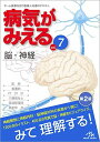 病気がみえるvol.7 脳・神経 医療情報科学研究所