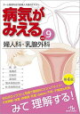 メディックメディア 病気がみえる Vol.9 婦人科・乳腺外科 第4版 2018