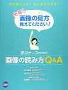 学ぶナースのための画像の読み方Q&A 先輩!画像の見方教えてください!