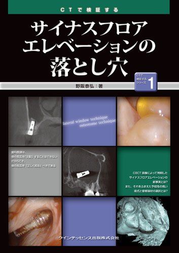 楽天市場】サイナスフロアエレベーションの通販 楽天市場】サイナスフロアエレベーションの通販