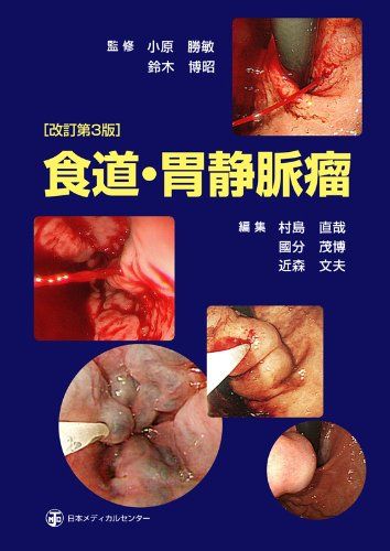 楽天市場】食道・胃静脈瘤の通販
