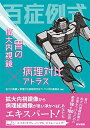 百症例式 胃の拡大内視鏡×病理対比アトラス
