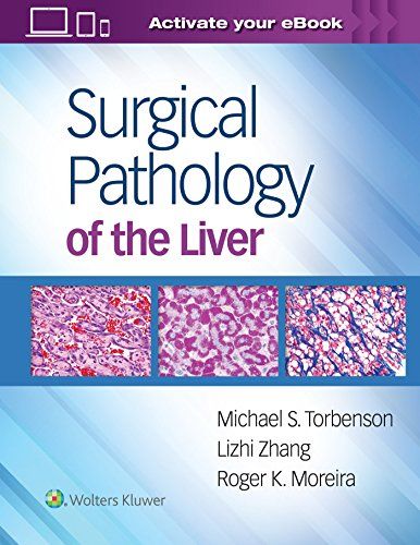 Surgical Pathology of the Liver [ハードカバー] Torbenson MD， Michael、 Moreira MD， Roger; Zhan..