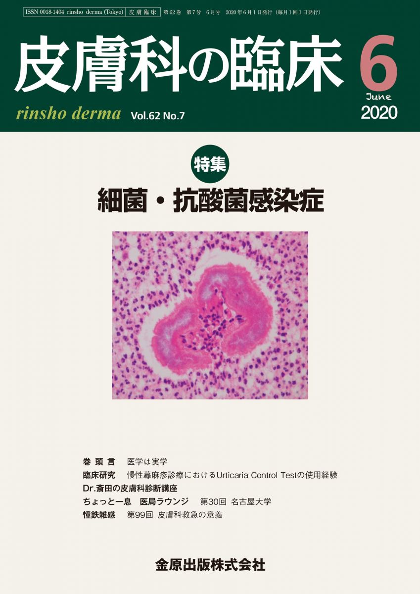 皮膚科の臨床 2020年 06 月号 [雑誌]
