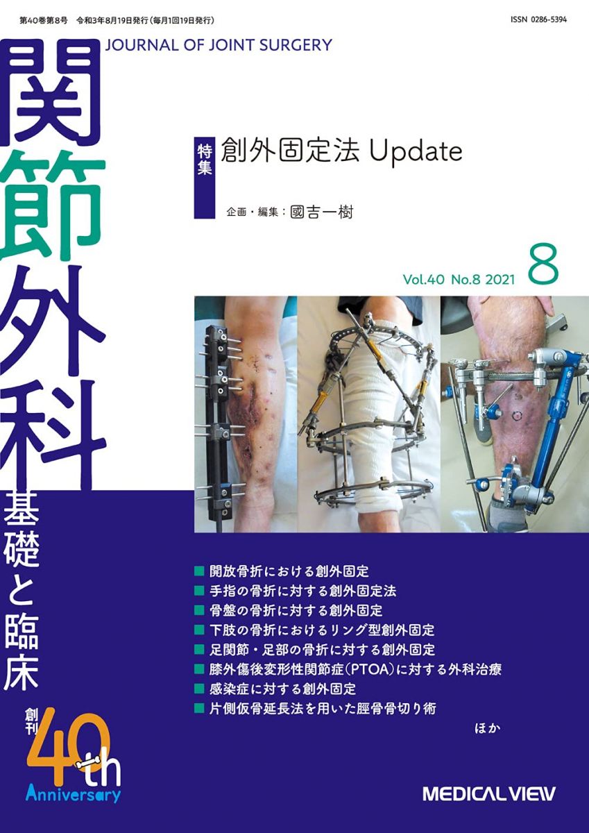 関節外科 -基礎と臨床 2021年8月号 特集:創外固定法Update