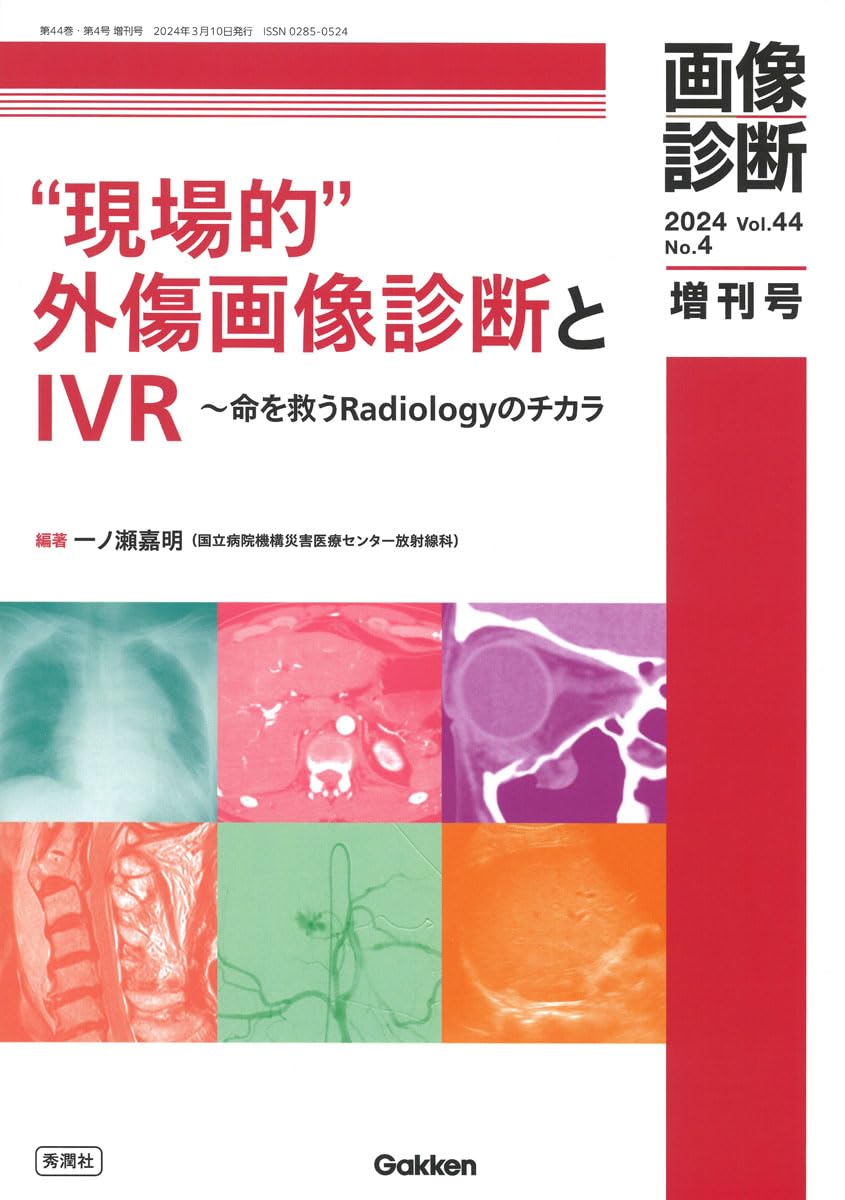 画像診断2024年増刊号Vol.44 No.4: “現場的“外傷画像診断とIVR−命を救うRadiologyのチカラ (画像診断増..