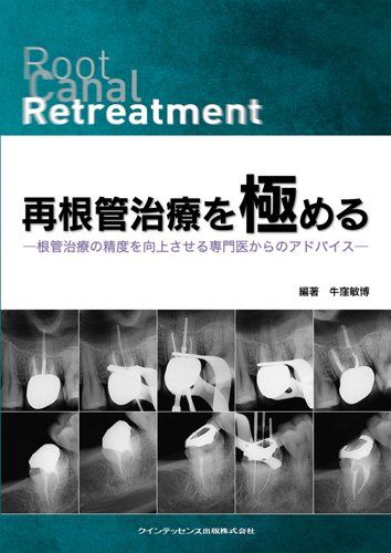 再根管治療を極める [単行本（ソフトカバー）] 牛窪 敏博、 石井 宏、 尾上 正治、 尾上 由枝; 横田 要