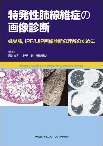 特発性肺線維症の画像診断 蜂巣肺，IPF/UIP画像診断の理解のために [単行本] 酒井文和、 上甲剛; 野間恵之