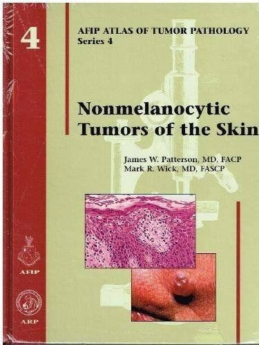 Nonmelanocytic Tumors of the Skin (Atlas of Tumor Pathology Series IV) ハードカバー Patterson，James W.